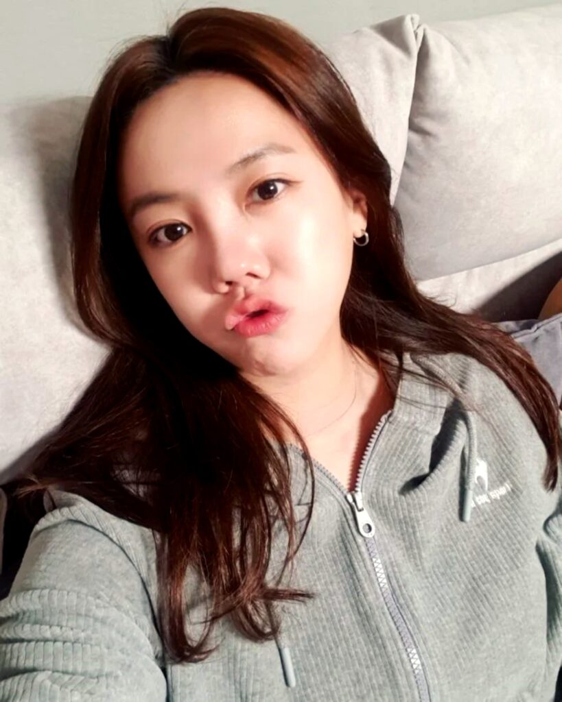 코 수술