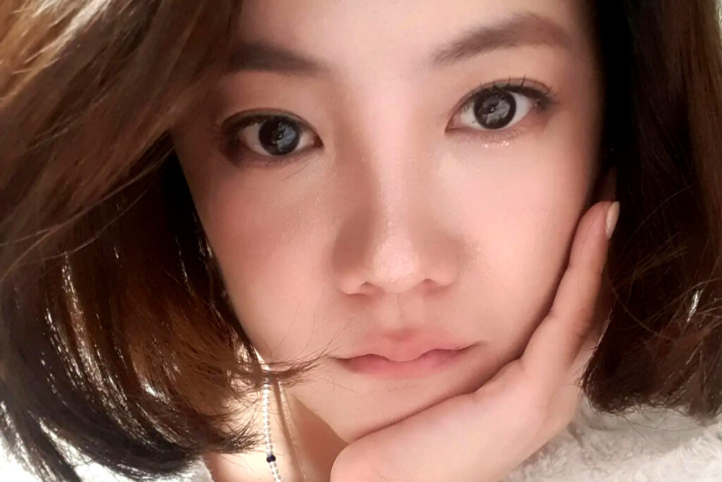 코 수술