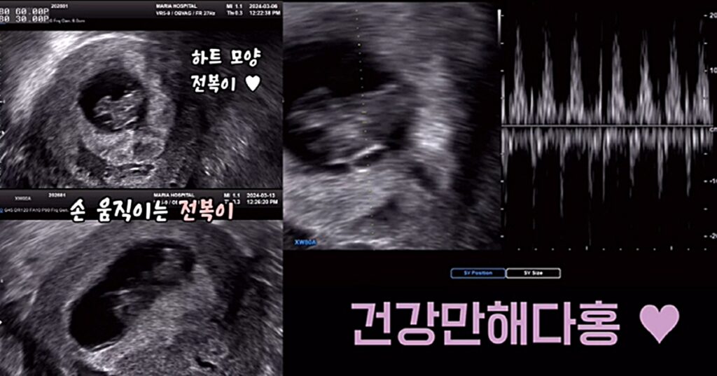 23살 차이 박수홍♥김다예 부부, 3년 만에 전해온 ‘깜짝' 소식 2 박수홍
