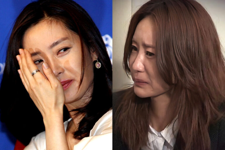 부상 연예인