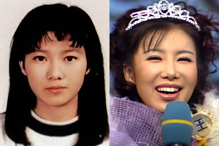 노현희 성형