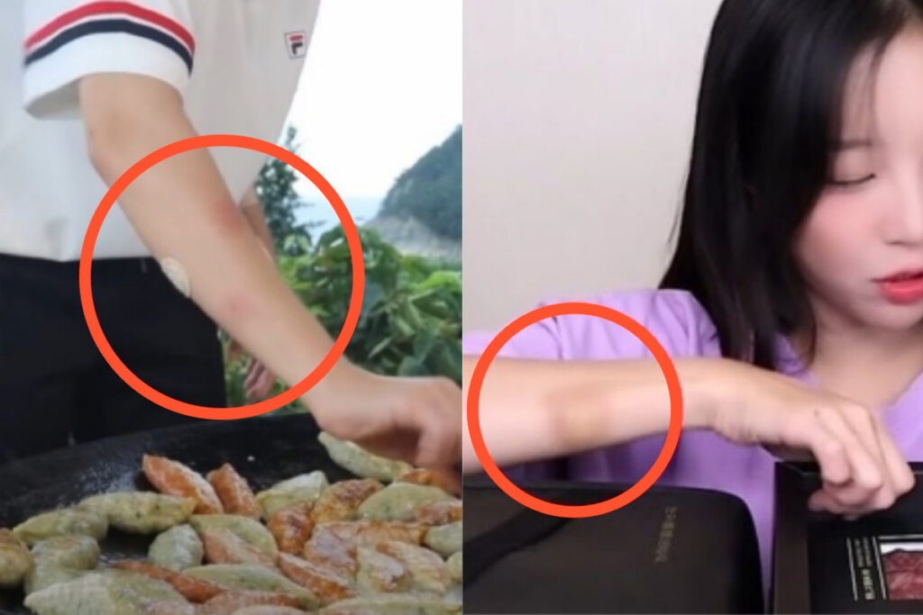 "어떻게 이런 일이..." 쯔양, '전남친에 맞은 증거' 이렇게나 많았어?! (+사진) 1 쯔양
