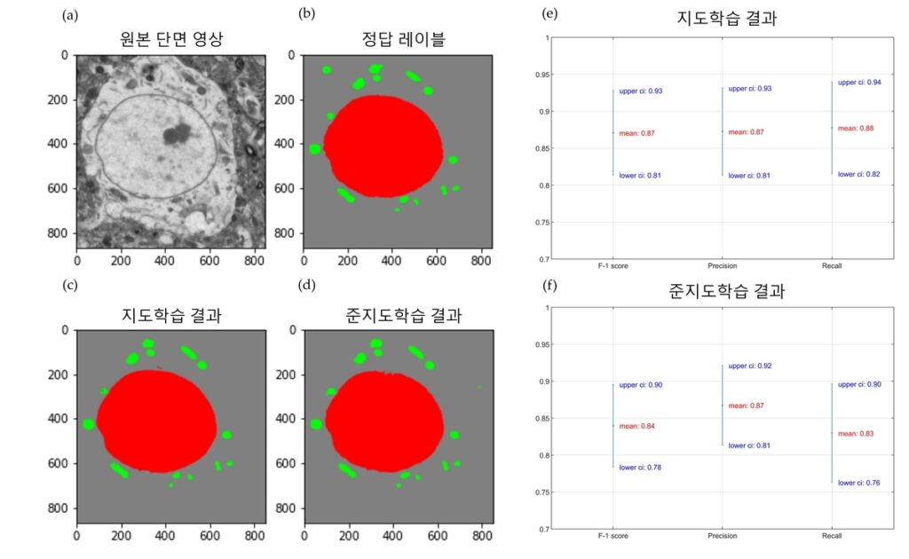 반도체 위기라더니 "한국 연구진이 해냈다"…놀라운 기술력에 업계 '발칵' 3 인공지능 영상 재구성 기술