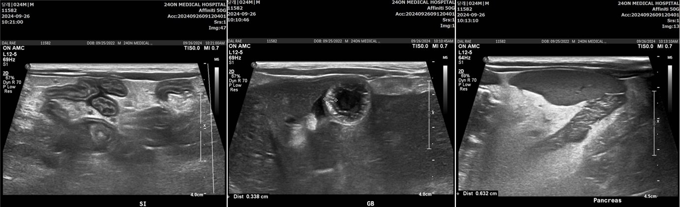 공복토 한 고양이 검사했더니 담관간염…치료방법은[벳앤패밀리] - 뉴스1