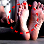 국내 췌장암 조기발견