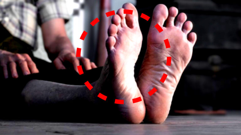 국내 췌장암 조기발견