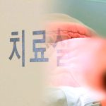 도수치료